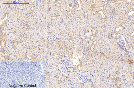 Immunohistochemical analysis of paraffin-embedded Human Skin Tissue using Collagen I Mouse mAb diluted at 1:200.