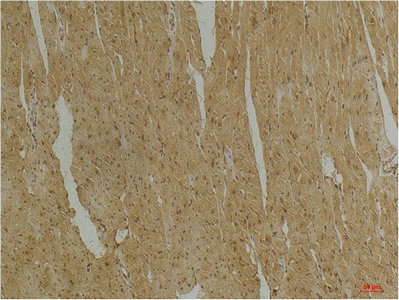 Immunohistochemical analysis of paraffin-embedded Mouse Heart Tissue using DesminMouse mAb diluted at 1:200.