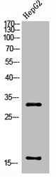 Western Blot analysis of HepG2 cells using Cleaved-Caspase-3 p17 (D175) Polyclonal Antibody