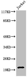 Western Blot analysis of Jurkat cells using Cleaved-Caspase-7 p20 (D198) Polyclonal Antibody Western Blot analysis of Jurkat cells using Cleaved-Caspase-7 p20 (D198) Polyclonal Antibody