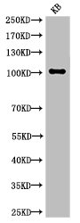 Western Blot analysis of KB cells using Cleaved-Notch 1 (V1754) Polyclonal Antibody Western Blot analysis of KB cells using Cleaved-Notch 1 (V1754) Polyclonal Antibody