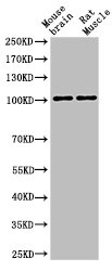 Western Blotting(WB) 2- Cleaved-NOTCH1 (V1754) Antibody
