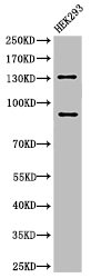 Western Blotting(WB) 1- Cleaved-NOTCH2 (D1733) Antibody