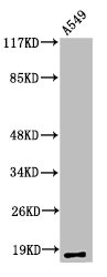 Western Blotting(WB) 1- Cleaved-MMP1 (F100) Antibody