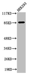 Western Blot analysis of 293 cells using Cleaved-MPO 89k (A49) Polyclonal Antibody Western Blot analysis of 293 cells using Cleaved-MPO 89k (A49) Polyclonal Antibody