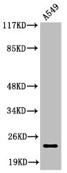 Western Blot analysis of A549 cells using Cleaved-PARP-1 (D214) Polyclonal Antibody Western Blot analysis of A549 cells using Cleaved-PARP-1 (D214) Polyclonal Antibody