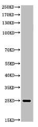 Western Blot analysis of HIS-protein cells using His-tag Polyclonal Antibody Western Blot analysis of HIS-protein cells using His-tag Polyclonal Antibody