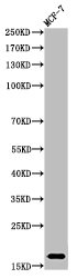 Western Blot analysis of MCF-7 cells using Mono-Methyl-Histone H3 (K37) Polyclonal Antibody Western Blot analysis of MCF-7 cells using Mono-Methyl-Histone H3 (K37) Polyclonal Antibody
