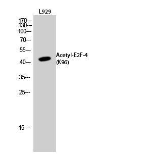 Western Blot analysis of L929 cells using Acetyl-E2F-4 (K96) Polyclonal Antibody Western Blot analysis of L929 cells using Acetyl-E2F-4 (K96) Polyclonal Antibody