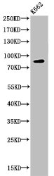 Western Blotting(WB) 1- Acetyl-HSP90AA1 (K292/284) Antibody
