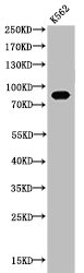Western Blotting(WB) 2- Acetyl-HSP90AA1 (K292/284) Antibody