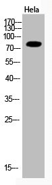 Western Blot analysis of Hela cells using Acetyl-Ub (K33) Polyclonal Antibody Western Blot analysis of Hela cells using Acetyl-Ub (K33) Polyclonal Antibody