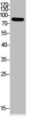 Western Blot analysis of HeLa cells using Acetyl-Ub (K33) Polyclonal Antibody