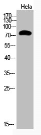 Western Blot analysis of Hela cells using Acetyl-Ub (K48) Polyclonal Antibody Western Blot analysis of Hela cells using Acetyl-Ub (K48) Polyclonal Antibody