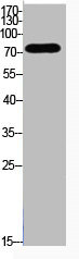 Western Blot analysis of HeLa cells using Acetyl-Ub (K48) Polyclonal Antibody