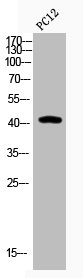 Western Blotting(WB) 1- Acetyl-JUN (K271) Antibody