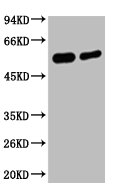 Western blot analysis of Hela, diluted at 1) 1:2000 2) 1:5000 Western blot analysis of Hela, diluted at 1) 1:2000 2) 1:5000