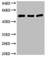 Western blot analysis of 1) Hela, 2) Mouse Brain, 3) HepG2, diluted at 1:2000.