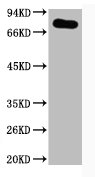 Western blot analysis of Hela, diluted at 1:1000. Western blot analysis of Hela, diluted at 1:1000.