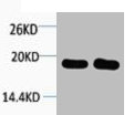 Western blot analysis of 1) Hela, 2) 3T3, diluted at 1:1000. Western blot analysis of 1) Hela, 2) 3T3, diluted at 1:1000.