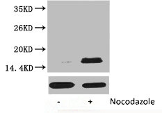 Western blot analysis of extracts from Hela cells, untreated (-) or treated, 1:2000 Western blot analysis of extracts from Hela cells, untreated (-) or treated, 1:2000