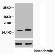 Western blot analysis of extracts from Hela cells, untreated (-) or treated, 1:5000. Western blot analysis of extracts from Hela cells, untreated (-) or treated, 1:5000.