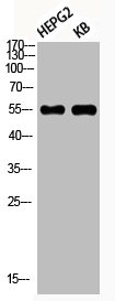 Western Blot analysis of HEPG2 KB using Phospho-Akt1 (S246) Polyclonal Antibody