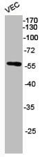 Western Blot analysis of VEC cells using Phospho-Akt (S473) Polyclonal Antibody