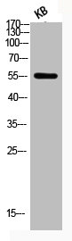 Western Blot analysis of KB using Phospho-Akt (S473) Polyclonal Antibody