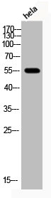 Western Blot analysis of hela cells using Phospho-Akt (T308) Polyclonal Antibody