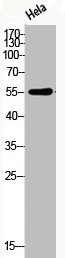 Western Blot analysis of HELA cells using Phospho-Akt (T308) Polyclonal Antibody