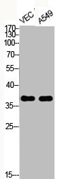 Western Blotting(WB) 2- Phospho-JUN (T93) Antibody