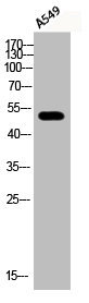 Western Blotting(WB) 1- Phospho-ATF2 (S112) Antibody