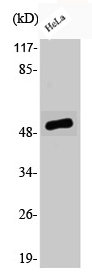 Western Blotting(WB) 1- Phospho-ATF2 (S62) Antibody