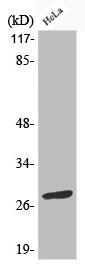 Western Blot analysis of HeLa cells using Phospho-Bcl-2 (S70) Polyclonal Antibody Western Blot analysis of HeLa cells using Phospho-Bcl-2 (S70) Polyclonal Antibody
