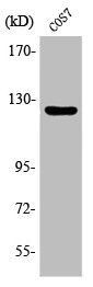 Western Blot analysis of Jurkat cells using Phospho-FAK (Y861) Polyclonal Antibody Western Blot analysis of Jurkat cells using Phospho-FAK (Y861) Polyclonal Antibody