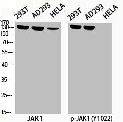 Western Blotting(WB) 2- Phospho-JAK1 (Y1022) Antibody