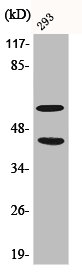 Western Blot analysis of 293 cells using Phospho-JNK1/2/3 (T183/Y185) Polyclonal Antibody Western Blot analysis of 293 cells using Phospho-JNK1/2/3 (T183/Y185) Polyclonal Antibody