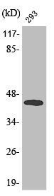 Western Blot analysis of 293 cells using Phospho-MEK-4 (T261) Polyclonal Antibody Western Blot analysis of 293 cells using Phospho-MEK-4 (T261) Polyclonal Antibody