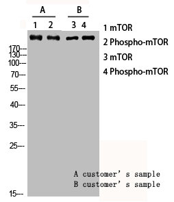 Western blot analysis of customers lysis using Phospho-mTOR (S2448) antibody.