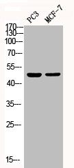 Western Blotting(WB) 1- Phospho-MAPK14 (Y182) Antibody
