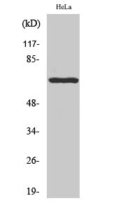 Western Blot analysis of HeLa cells using Phospho-Paxillin (Y118) Polyclonal Antibody Western Blot analysis of HeLa cells using Phospho-Paxillin (Y118) Polyclonal Antibody