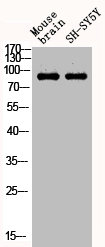 Western Blot analysis of MOUSE-BRAIN SH-SY5Y cells using Phospho-Stat1 (Y701) Polyclonal Antibody
