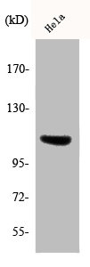 Western Blotting(WB) 1- Phospho-ITGB3 (Y785) Antibody