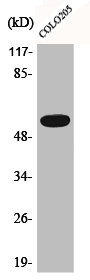 Western Blot analysis of COLO205 cells using Phospho-Akt (T308) Polyclonal Antibody