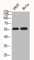 Western Blot analysis of 293T HELA cells using Phospho-Akt1/3 (Y437/434) Polyclonal Antibody