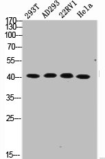 Western Blotting(WB) 2- Phospho-MYC (S62) Antibody