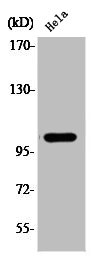 Western Blotting(WB) 1- Phospho-NFKB1 (S927) Antibody