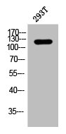 Western Blotting(WB) 1- Phospho-CTNND1 (Y228) Antibody