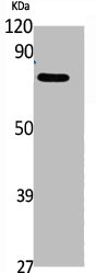 Western Blot analysis of K562, cells using Phospho-Rad17 (S646) Polyclonal Antibody Western Blot analysis of K562, cells using Phospho-Rad17 (S646) Polyclonal Antibody